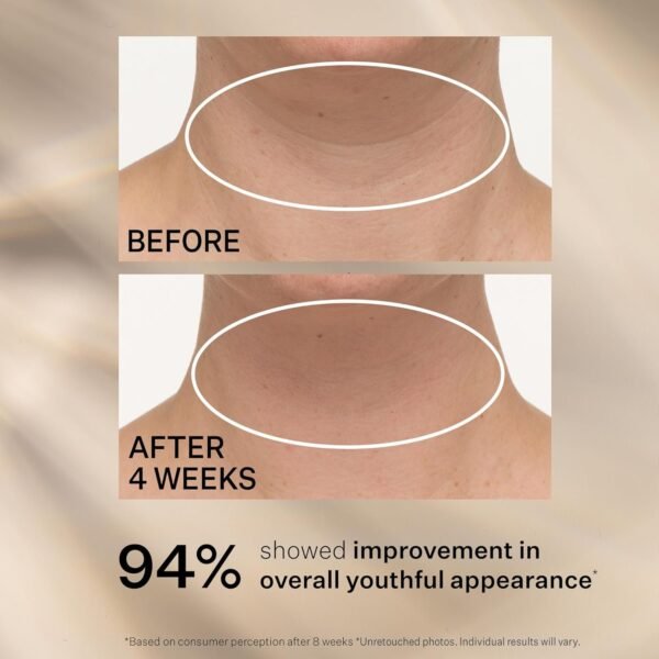 StriVectin StriVectin Tighten & Lift Advanced Neck Cream PLUS com Peptídeos™ Alfa-3 para Pescoço & Decote, Aparência suavizante de rugas e linhas finas, melhora a pele crepe & linhas verticais, para uma pele suave e suave. - Imagem 7