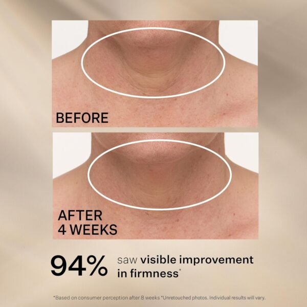 StriVectin StriVectin Tighten & Lift Advanced Neck Cream PLUS com Peptídeos™ Alfa-3 para Pescoço & Decote, Aparência suavizante de rugas e linhas finas, melhora a pele crepe & linhas verticais, para uma pele suave e suave. - Imagem 6